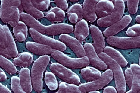 Louisiana Confirms 5 Fatalities from Necrotizing Bacterium in Coastal Waters